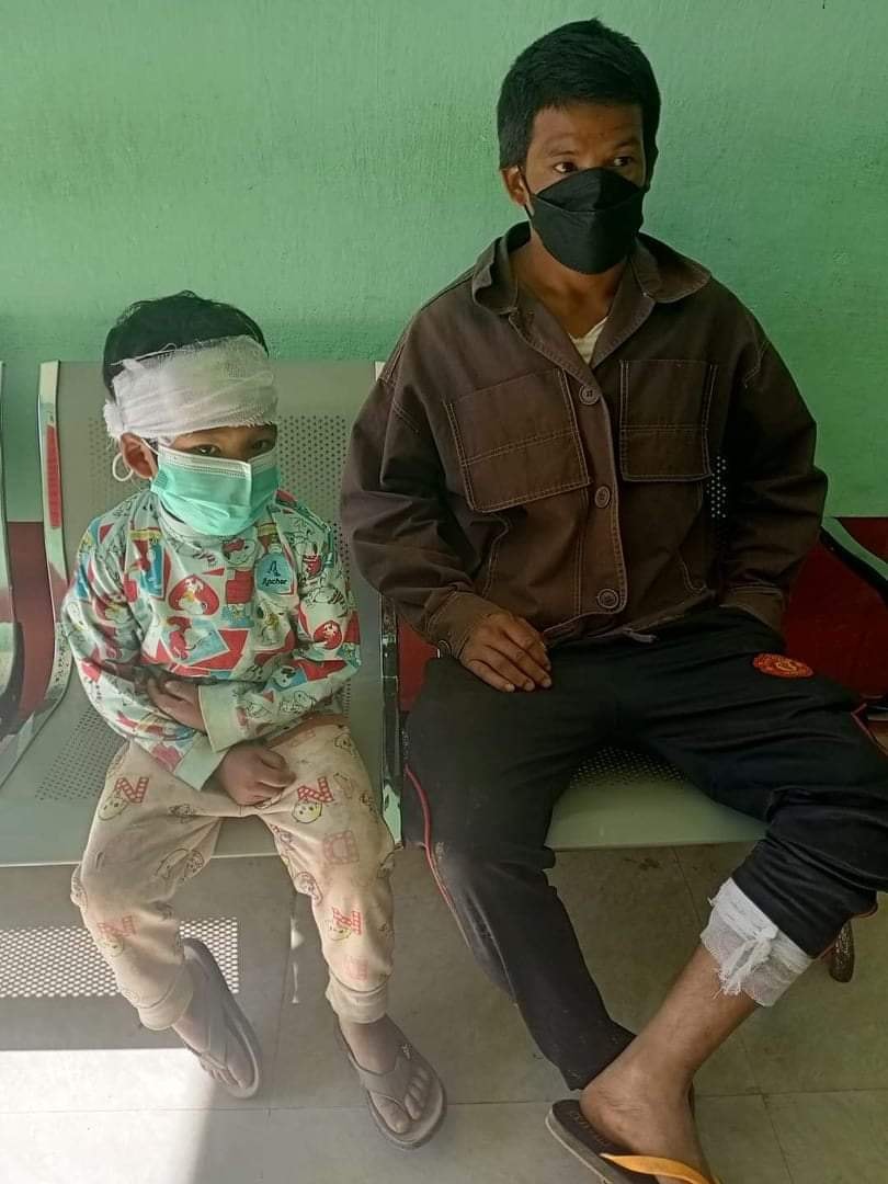 Fightings broke out in Namhkan (Northern Shan State) between TNLA & MAG (Minaunghlaing Armed Group) & 6 civilians got injured & 2 in serious conditions including children.   Urgent humanitarian aids needed