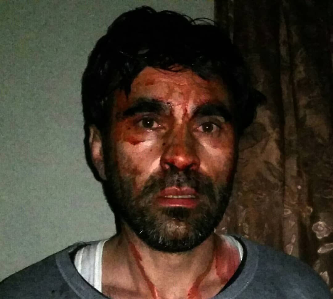 Afghan Journalist, Zaki Qais has been beaten by the Taliban in Kabul city last night